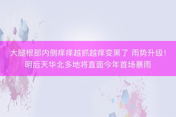 大腿根部内侧痒痒越抓越痒变黑了 雨势升级！明后天华北多地将直面今年首场暴雨
