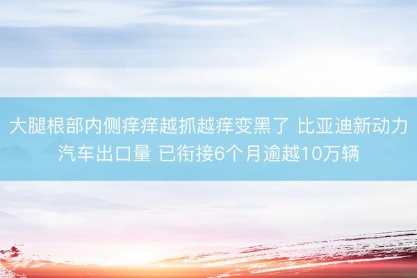 大腿根部内侧痒痒越抓越痒变黑了 比亚迪新动力汽车出口量 已衔接6个月逾越10万辆